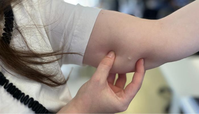 Procura por implante contraceptivo cresce 118% no SUS do Paraná em 2025